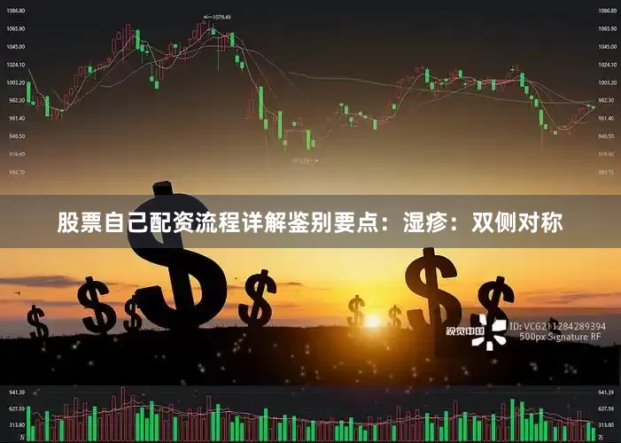 股票自己配资流程详解鉴别要点：湿疹：双侧对称